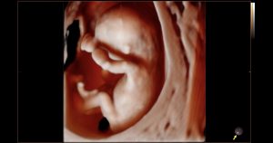 Appointment? at ultrasound happens your what 12-week What to