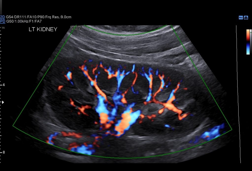 Renal Scan - Women's Imaging