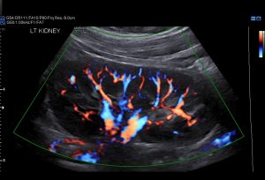 Renal - Women's Imaging